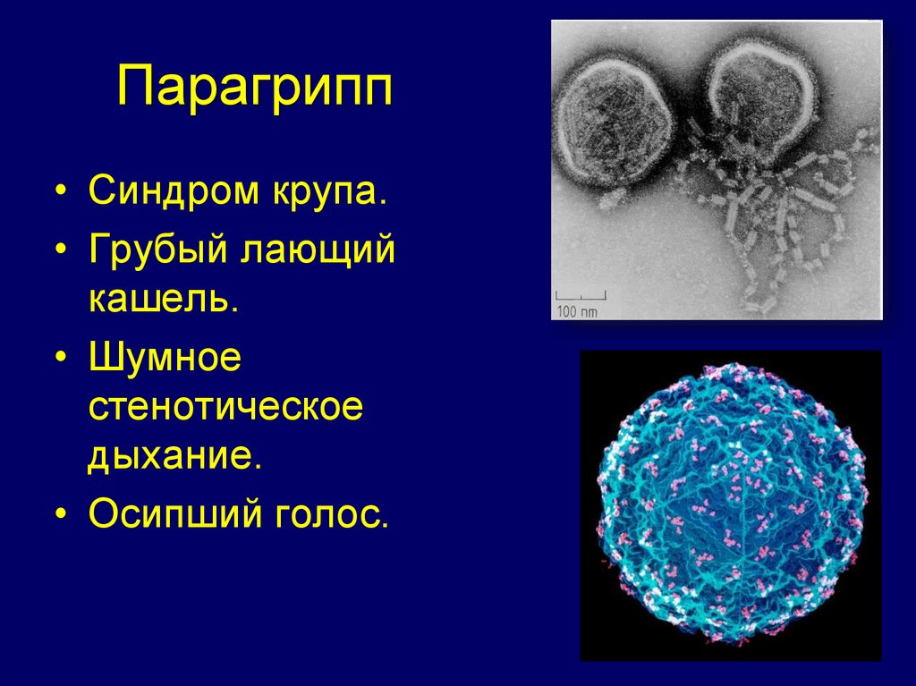 Грипп аденовирус. Возбудитель гриппа парагриппа. Парагрипп характеристика возбудителя. Типы возбудителей парагриппа (1-4). Вирус парагриппа симптомы.