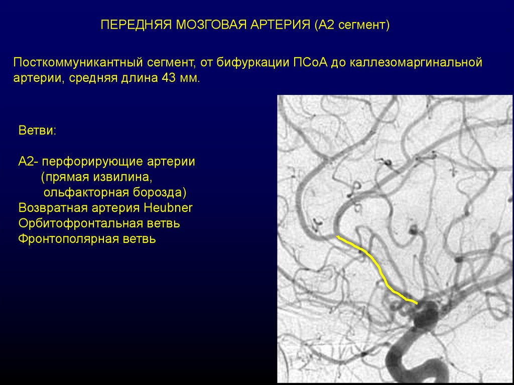 Сегмент а1 пма. Сегменты передней мозговой артерии. Средняя мозговая артерия. Сегменты средней мозговой артерии. Сосуды головного мозга анатомия.