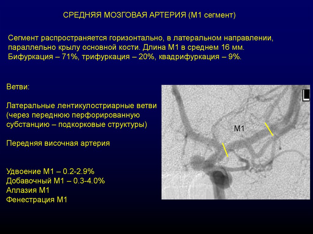 Артерии среднего мозга. М3 сегмент средней мозговой артерии. Сегменты средней мозговой артерии на кт схема. Средняя мозговая артерия анатомия м1 сегмент. М2 сегмент средней мозговой артерии кт.