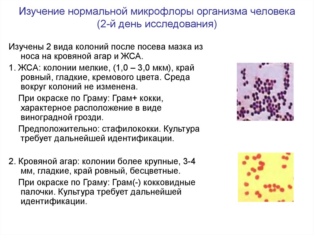 Микрофлора носа. Методы оценки микрофлоры человека. Ученые, изучающие нормальную микрофлору организма человека.. Виды микробной Флоры. Методы изучения нормальной микрофлоры.