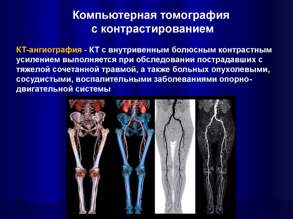 Лучевая диагностика опорно двигательной системы презентация