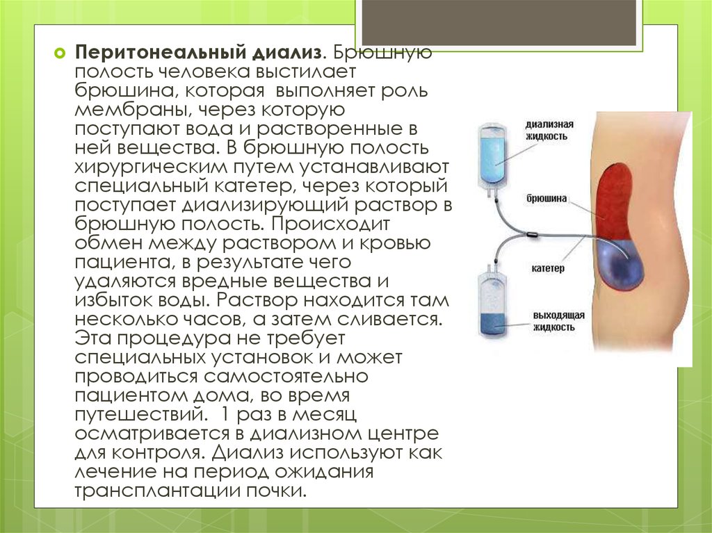 Перитонеальный диализ что это. Перитонеальный катетер для диализа. Перитонеальный диализ клинические рекомендации. Перитонеальный диализ брюшина. Принцип перитонеального диализа.