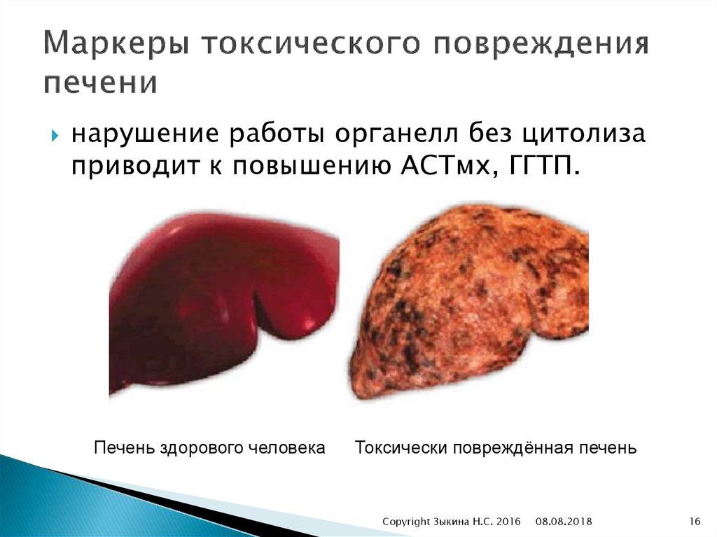 Маркеры токсического повреждения печени