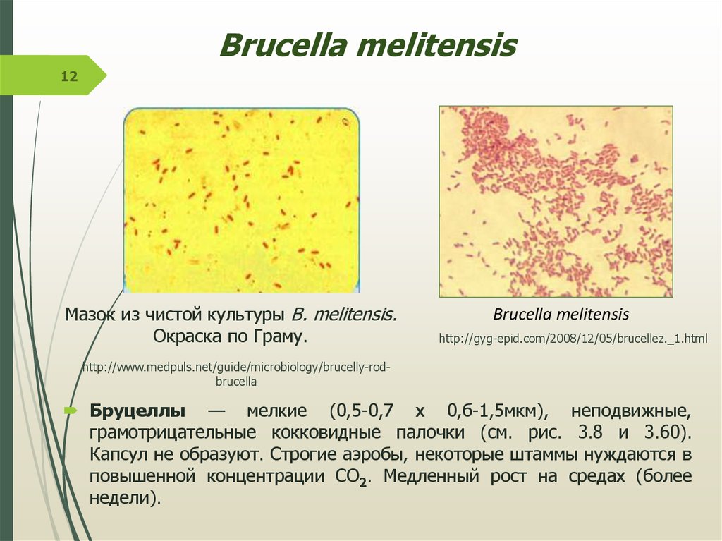 Возбудитель бруцеллеза картинка