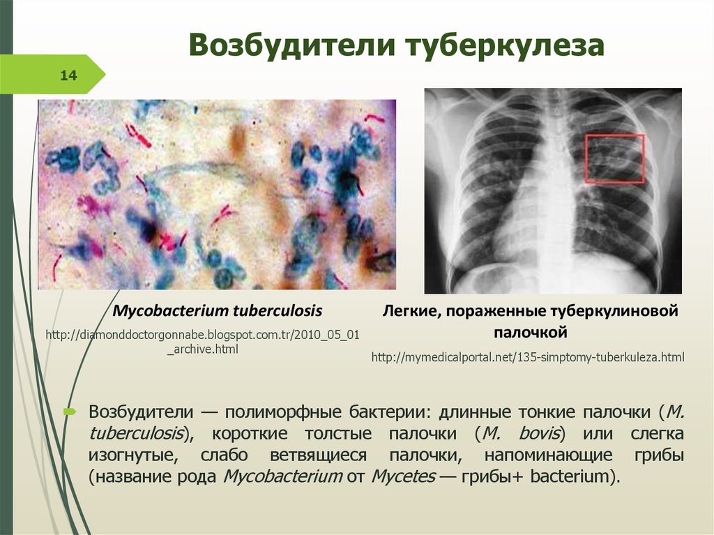 Микобактерии являются