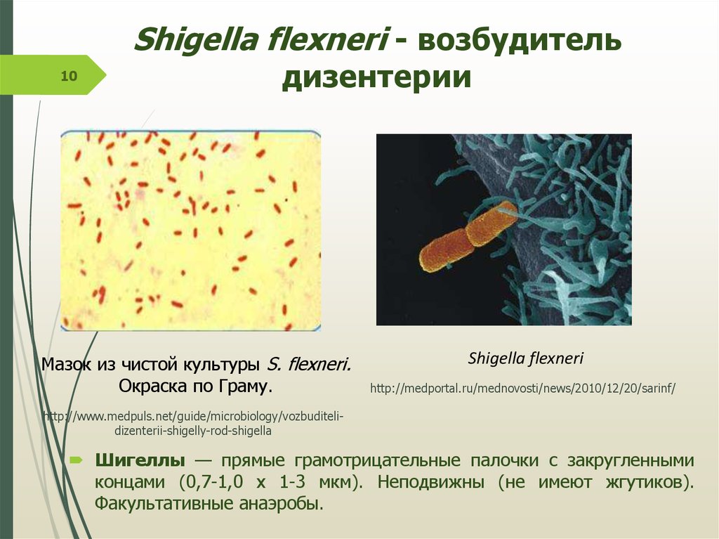 Возбудитель дизентерии. Шигелла жгутики. Shigella dysenteriae (шигелла дизентерия). Шигеллы факультативные анаэробы. Морфология шигелл микробиология.