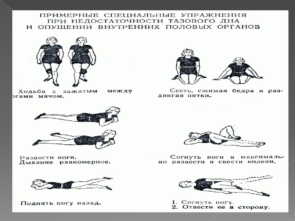 Лфк в гинекологии презентация