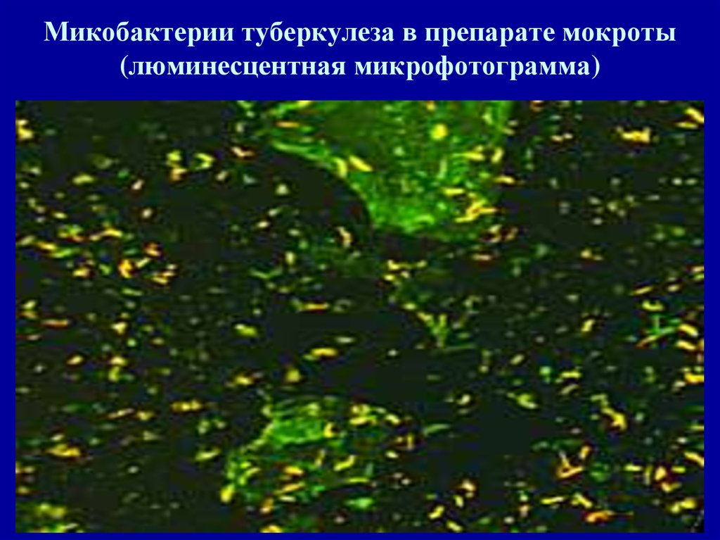 Микобактерии методы микроскопии