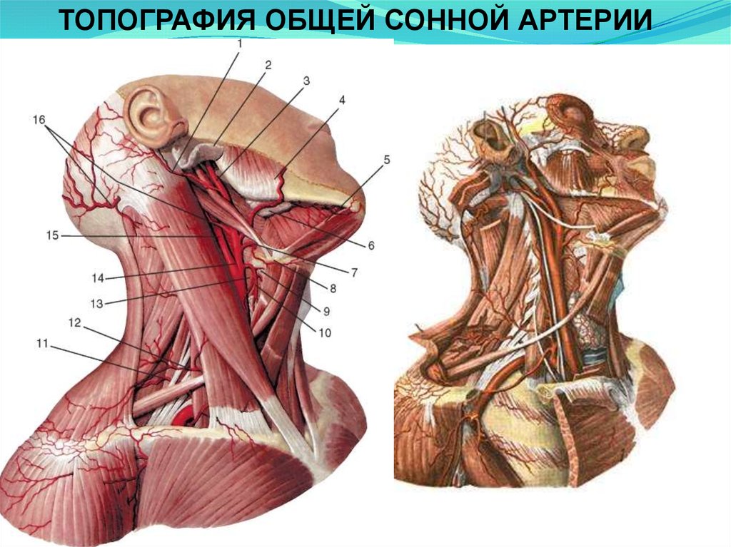 Сонные артерии на шее человека фото. Наружная Сонная артерия анатомия топография. Левая Сонная артерия кровоснабжает. Топография сонной артерии. Топография сонной артерии на шее.