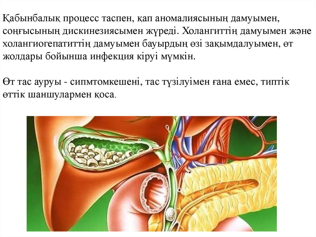 Созылмалы холецистит презентация