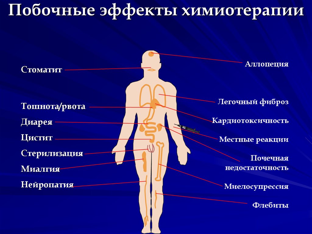 Последствия химиотерапии. Побочные реакции химиотерапии. Побочные эффекты противоопухолевой терапии. Химия терапия побочные эффекты. Побочные эффекты от химиоте.