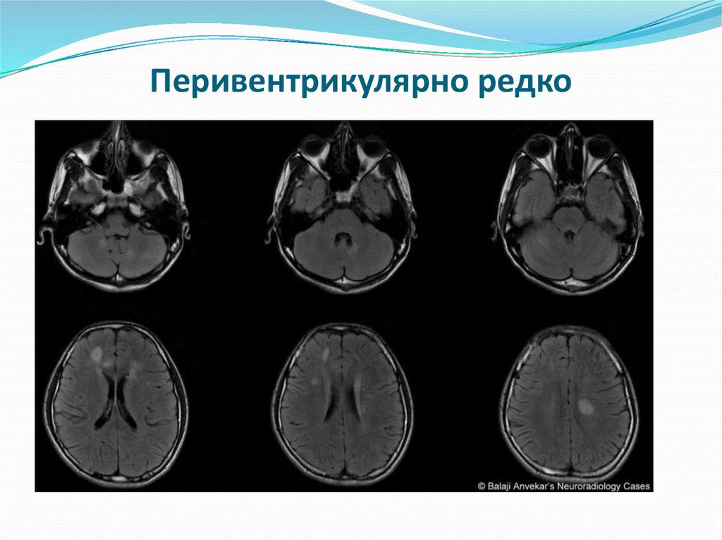 Орэм мрт картина