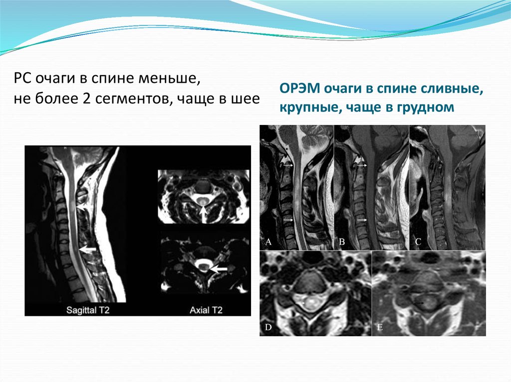 Орэм мрт картина