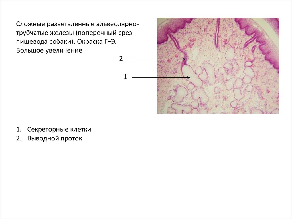 Трубчатая железа. Трубчатые и альвеолярные железы гистология. Альвеолярная трубчатая трубчатая железа. Сложная разветвленная альвеолярная железа. Альвеолярнотрубяатые железы пищевода.