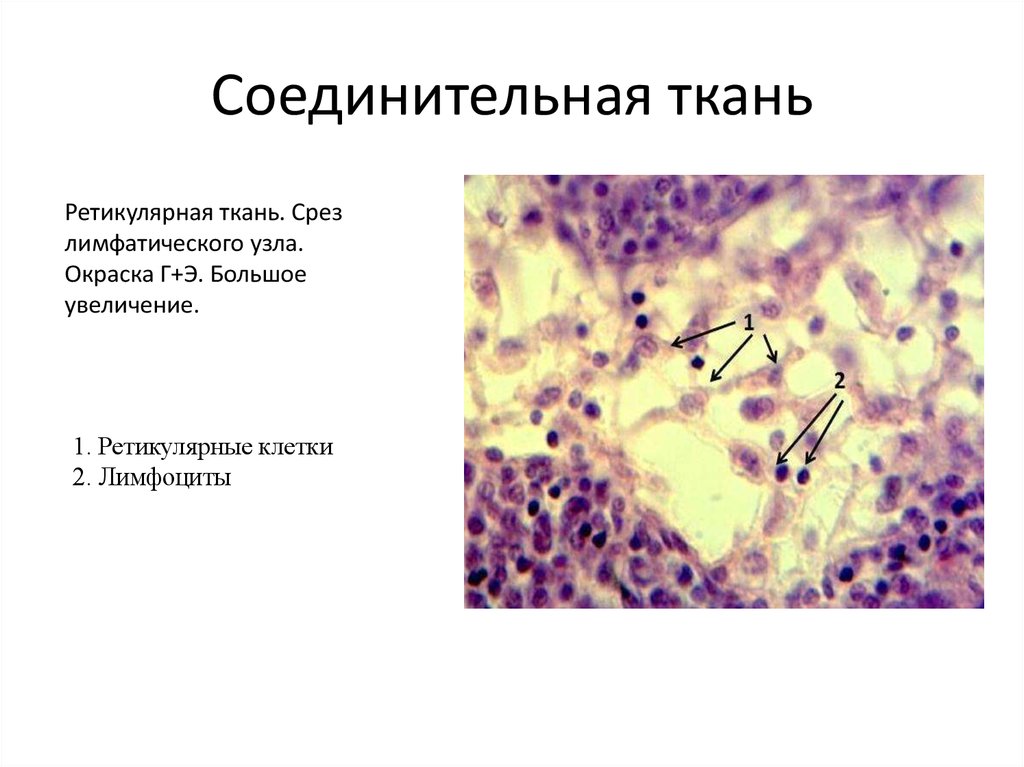 Рисунок ретикулярной ткани