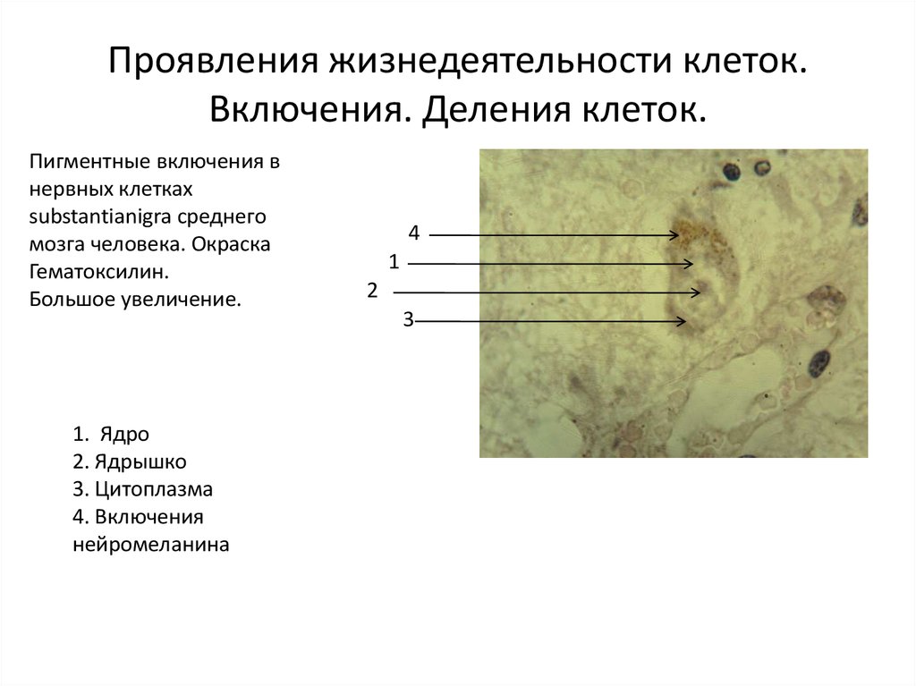 Средние клетки. Пигментные включения в нервной клетке. Основные проявления жизнедеятельности клеток. Пигментные включения в нервных клетках среднего мозга человека. Включения в эукариотических клетках.