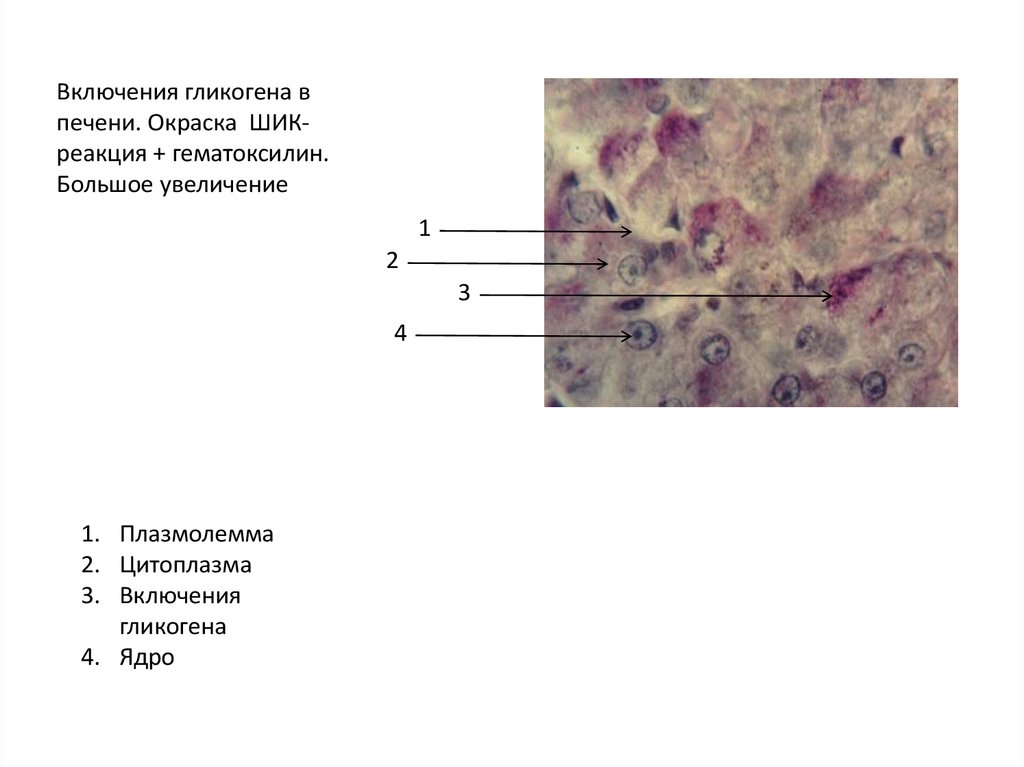 Включения гликогена в печени. Включения гликогена в клетках печени свиньи. Включения гликогена в печени аксолотля. Клетки печени аксолотля гистология. Включения гликогена окраска кармином.