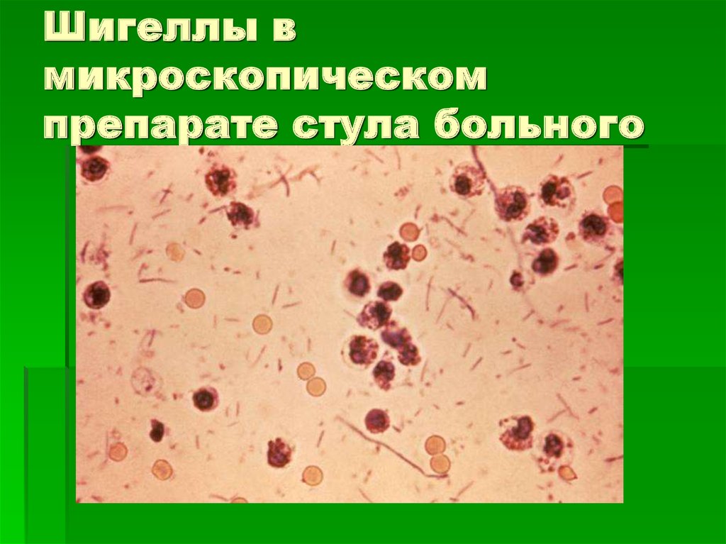 Шигеллез микробиология презентация