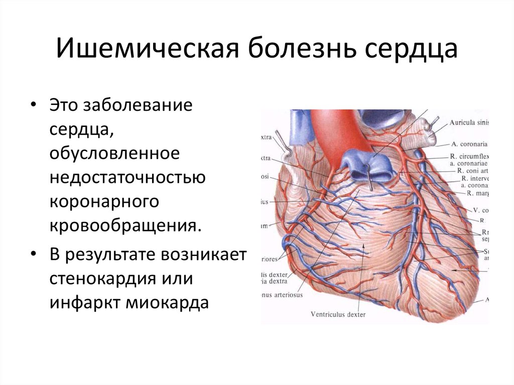 Что такое ишемическая болезнь сердца. Ишемическая болезнь сердца (ИБС). Клинические симптомы ИБС. Ишемическая болезнь сердца симптомы причины. Понятие об ишемической болезни сердца.