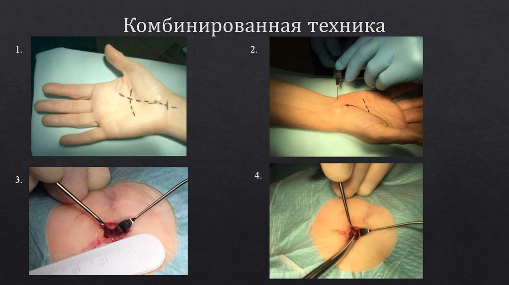 Комбинированная техника