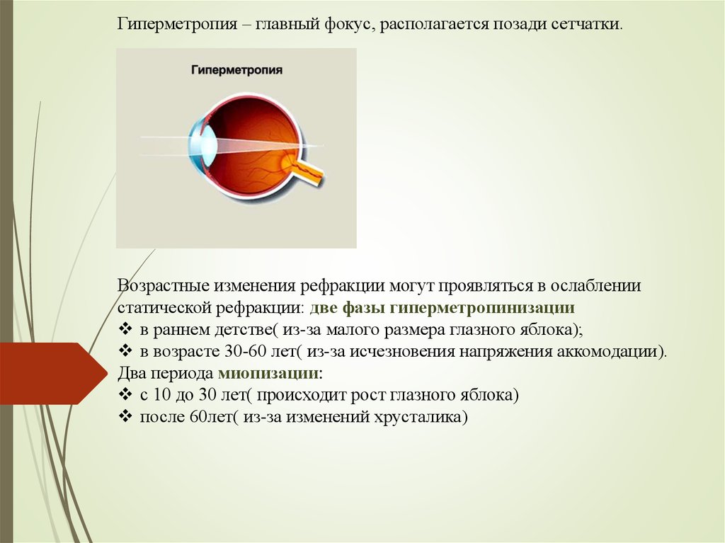 Перед сетчаткой расположена. Заболевание глаз гиперметропия. Гиперметропия причины возникновения. Клинические проявления гиперметропии. Дальнозоркость (гиперметропия).