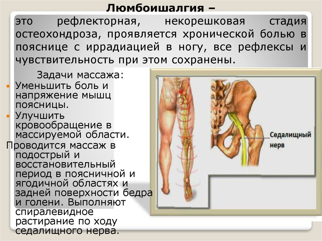 Иррадиация боли в ногу. Рефлекторные синдромы остеохондроза. Рефлекторные синдромы остеохондроза поясничного отдела. Боль в пояснице с иррадиацией в ногу. Боли в ногах при остеохондрозе.