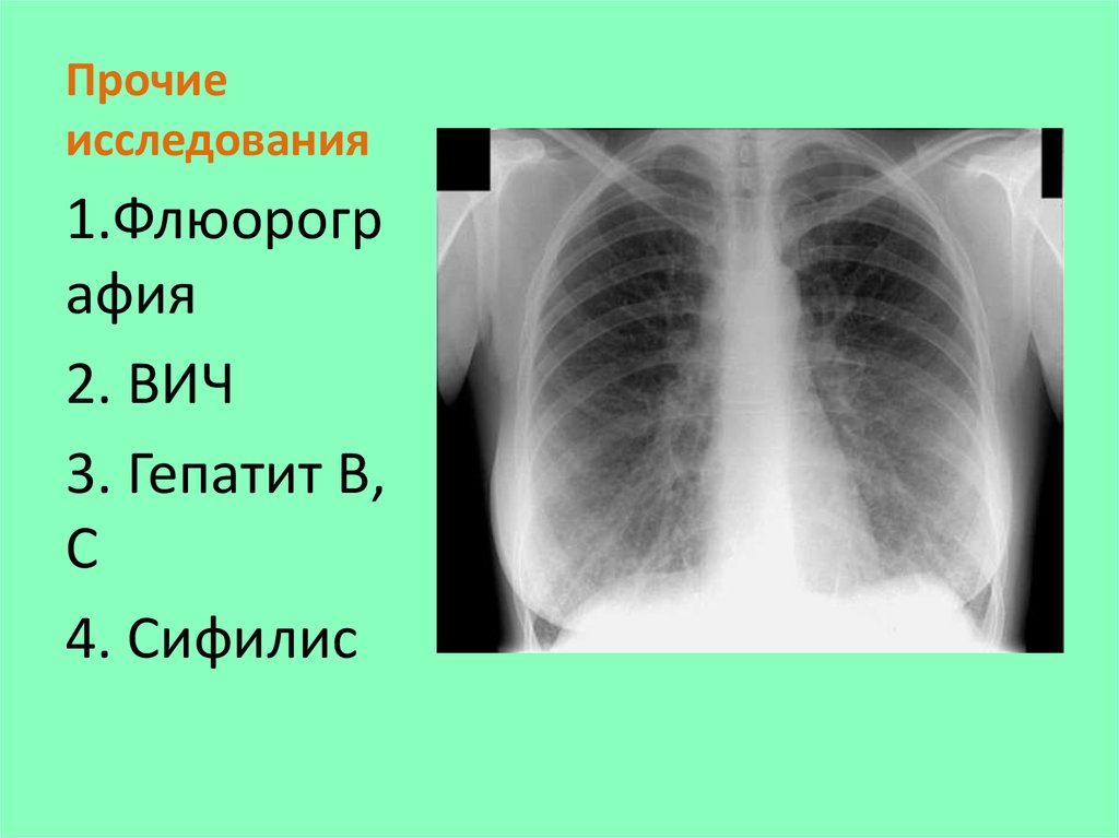 Прочие исследования