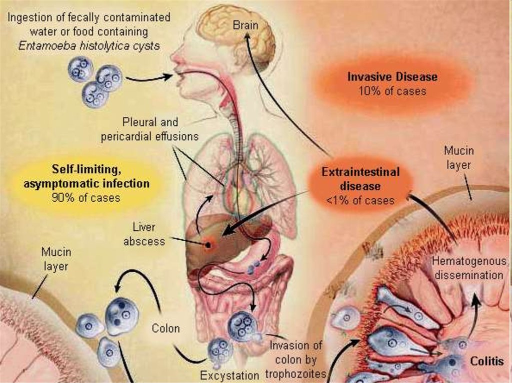 amoebiasis-amoebic-dysentery-online-presentation