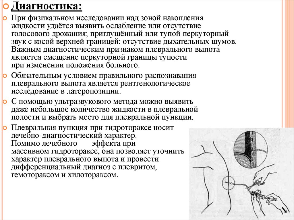 Пункция плевральной жидкости. Пункция при гидротораксе схема. Пункция плевральной полости при гидротораксе алгоритм. Пункция при гидротораксе техника выполнения. Пункция плевральной полости при гидротораксе техника.
