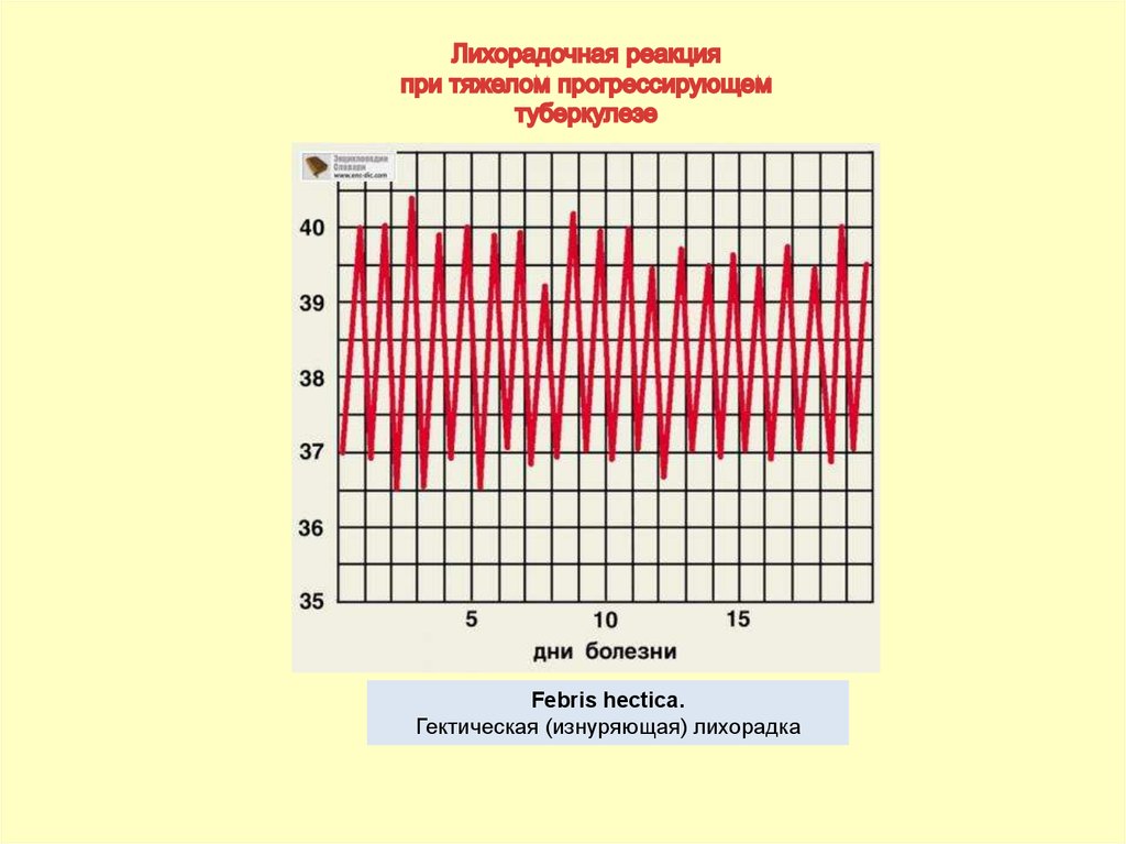 Гектический тип лихорадки