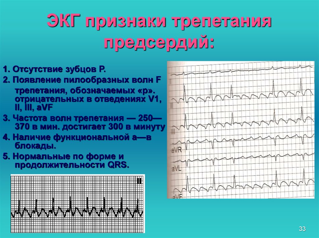 План описания экг