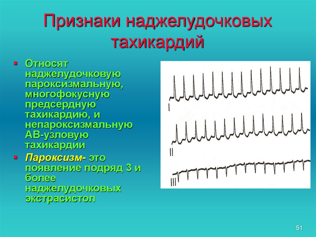 Признаки тахикардии