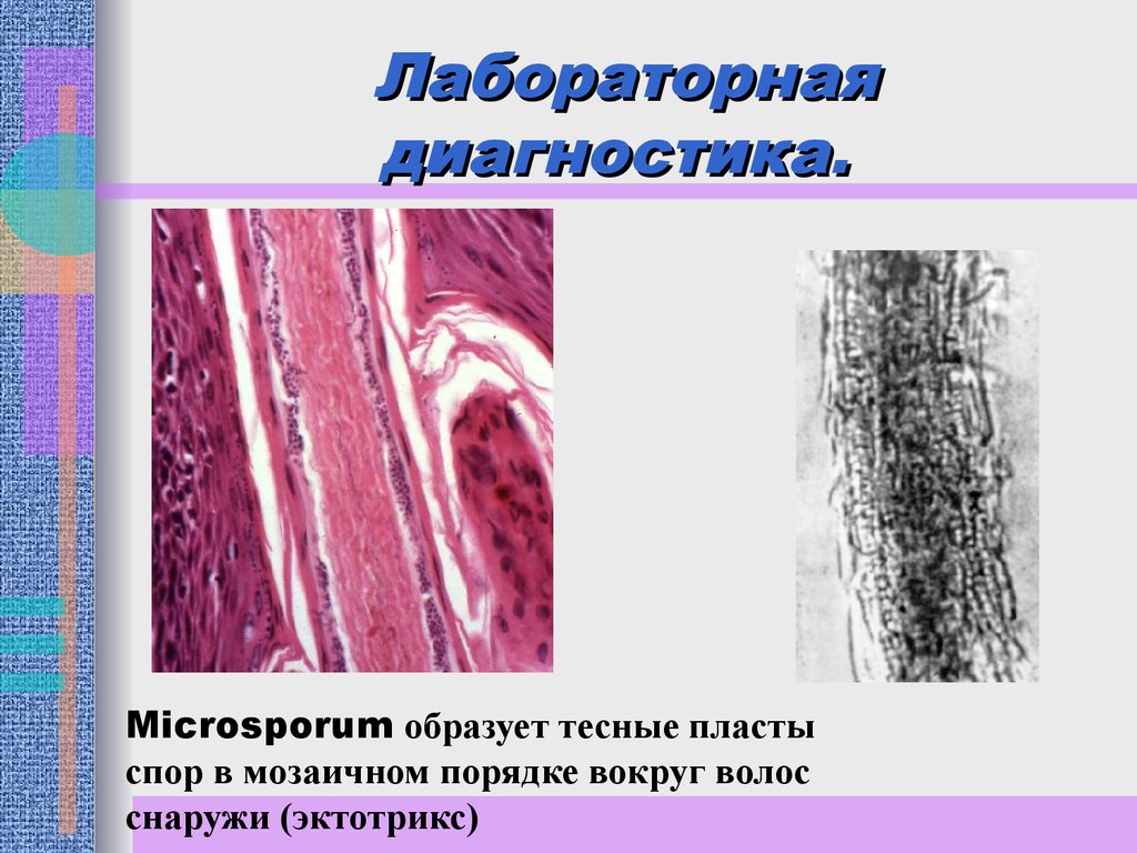 Диагностика микозов презентация