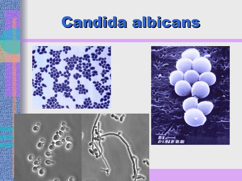 Candida albicans лечение. Кандида альбиканс микроскопия. Candida albicans возбудитель.