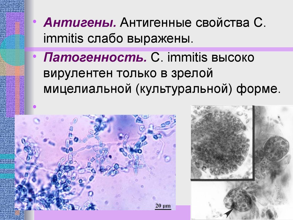 Патогенные микобактерии. Actinomyces israelii морфология. Возбудитель актиномикоза патогенность. Актиномикоз патогенность. Возбудители грибковых инфекций.