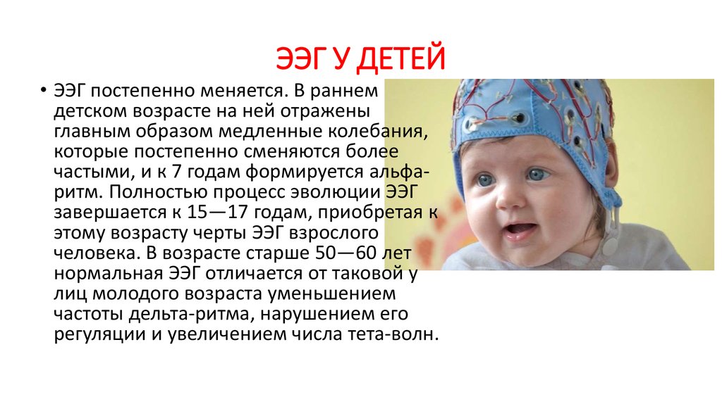 Ээг 3 лет. Энцефалограмма мозга ребенку. ЭЭГ ребенку 2 года. Электроэнцефалография у детей. ЭЭГ детям до года.