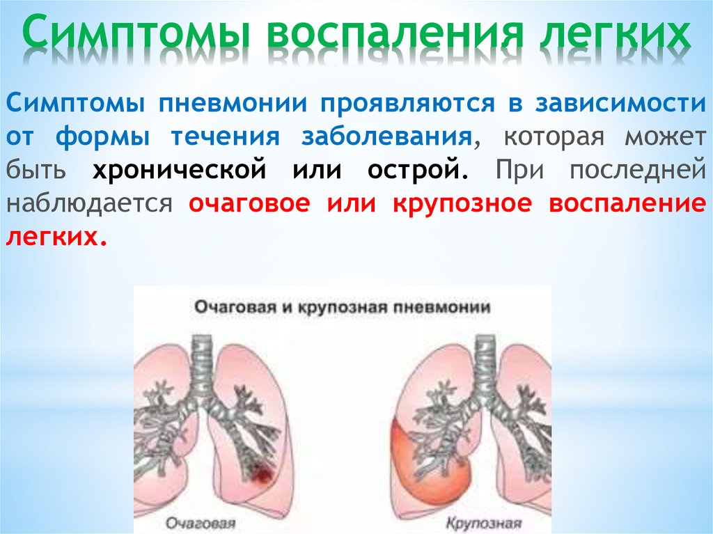 Пневмония легких опасно. Симптомы воспаления легких. Воспаление лёгких симптомы. Легочные проявления пневмонии. Пневмония симптомы у взрослых.