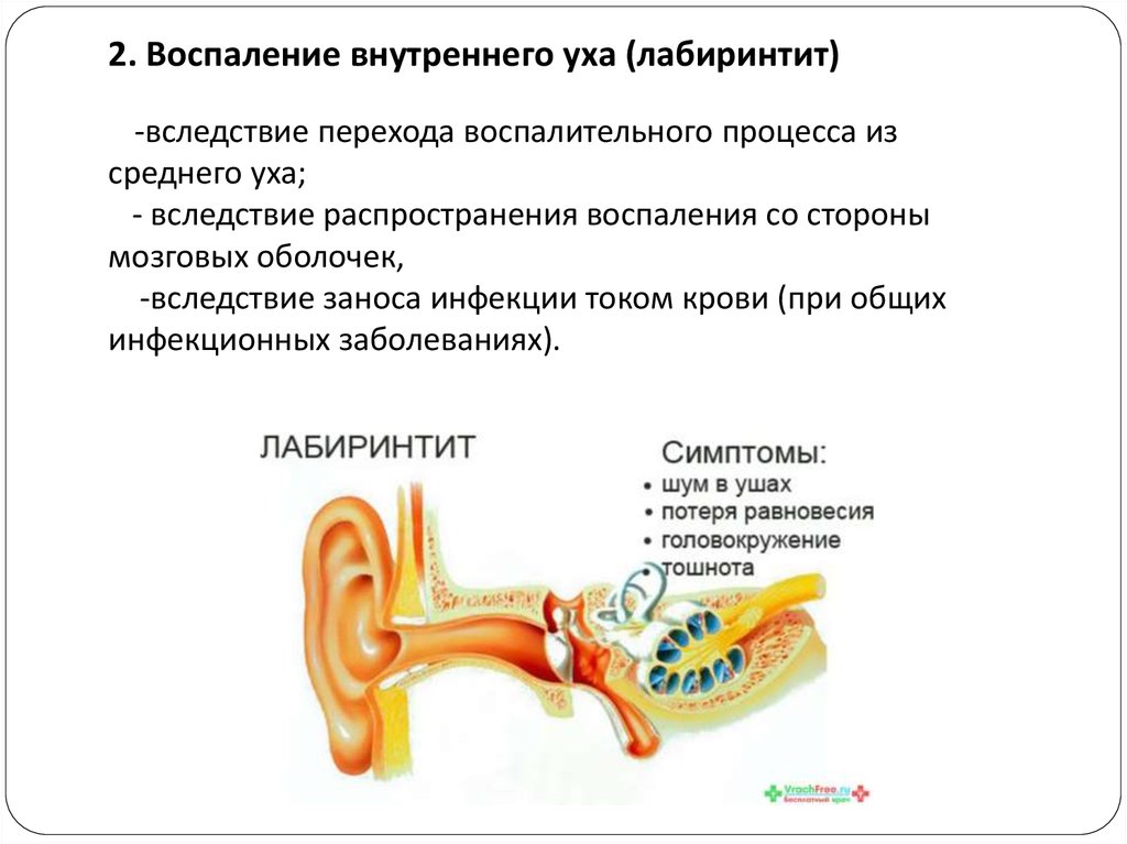 Нарушение внутреннего уха. Внутренний отит (лабиринтит). Заболевания внутреннего уха таблица. Воспаление внутреннего уха лабиринтит. Острый лабиринтит симптомы.