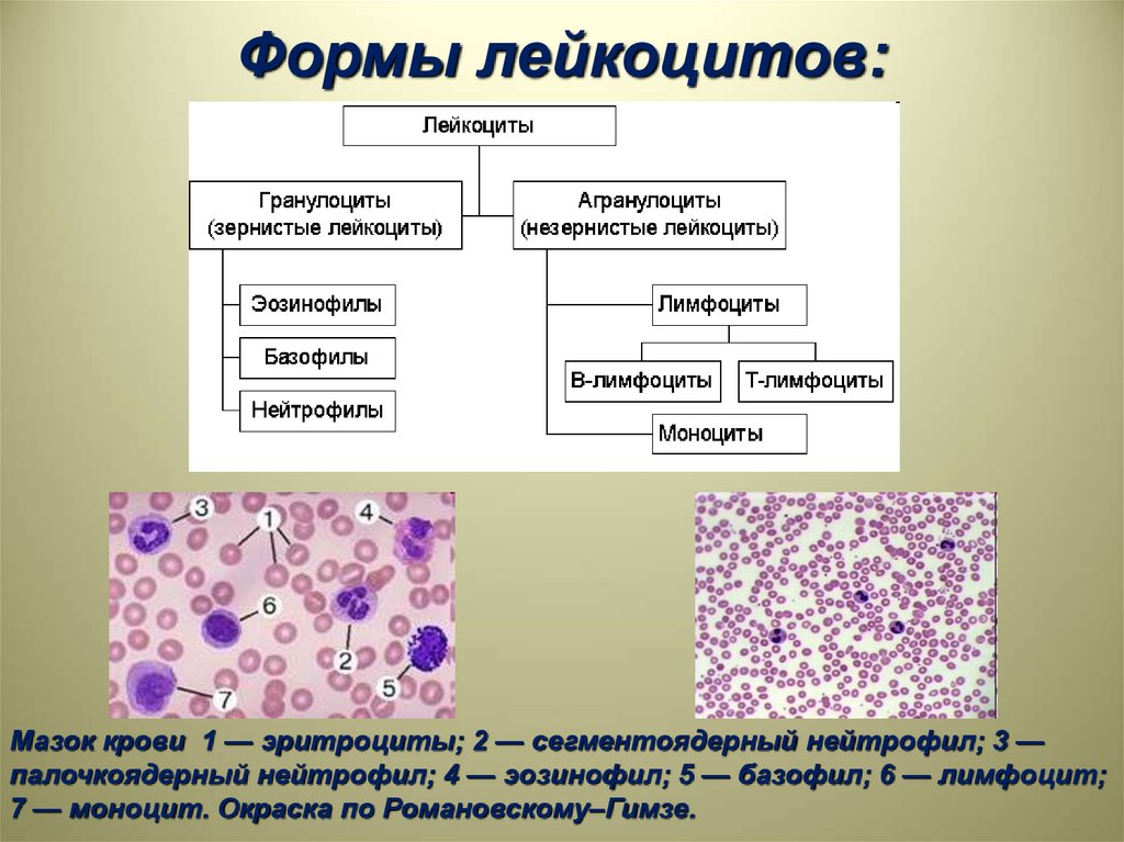 Форменные элементы формы. Форма лейкоцитов. Форма лейкоцитов в крови человека. Лейкоциты форма клетки. Виды лейкоцитов гранулоциты.