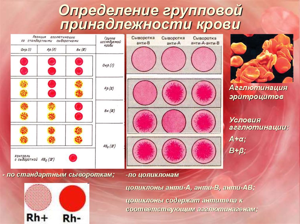 Группа крови клетки. Таблица агглютинации групп крови. Определение групповой принадлежности крови. Группы крови стандартными сыворотками. Определение группы крови сыворотками.