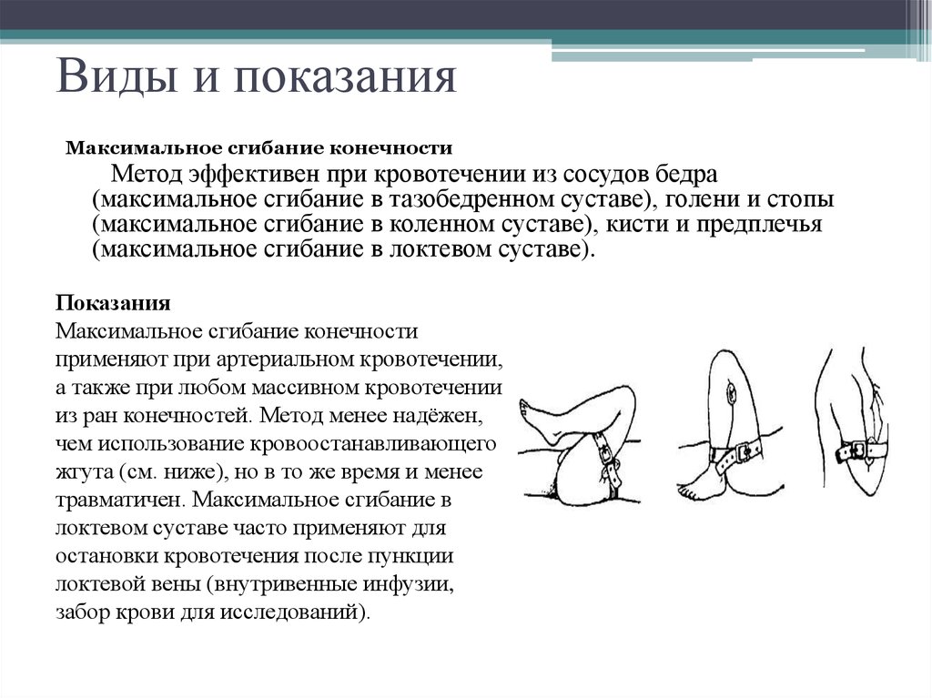 Виды показаний. Максимальное сгибание конечности показания. Максимальное сгибание конечности осложнения. Виды показаний обвиняемого.