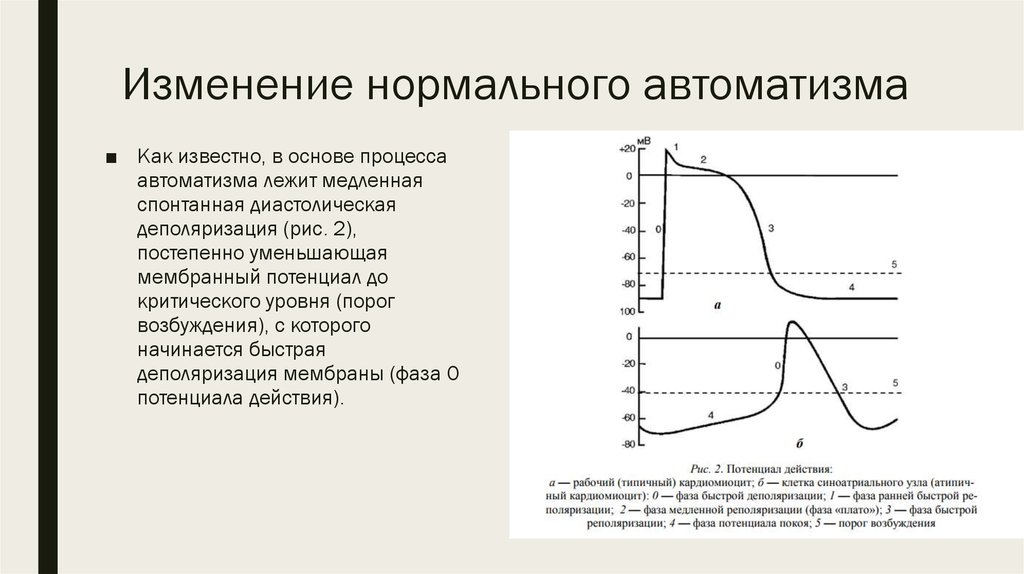 Нормальное изменение. Изменение нормального АВТОМАТИЗМА. Фаза плато потенциала действия кардиомиоцита. Медленная диастолическая деполяризация. Фазы потенциала действия клеток синоатриального узла.