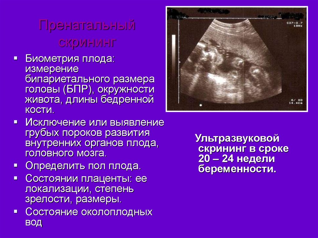 Бпр на узи при беременности. Бипариетальный размер головы. Бипариетальный размер головки. БПР плода. Измерение бипариетального размера головки плода.