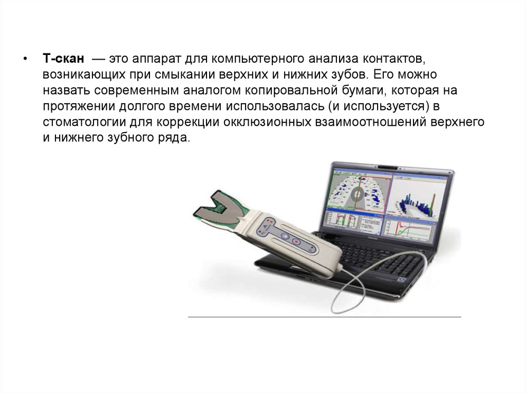 Скан под. Аппарат т-scan в стоматологии. Система t-scan III. T-scan Core аппарат для цифрового анализа окклюзии. Окклюзиография с аппаратом t-scan.