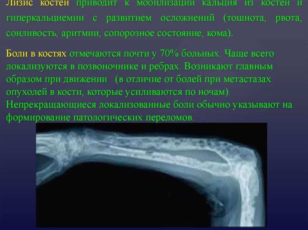 Миеломная болезнь - презентация онлайн