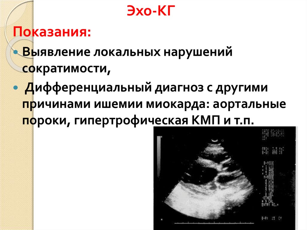 Эхо кг что это. Эхокардиография показания. Показания к эхокардиографии. Эхо кг показания. Эхо кг показания к проведению.