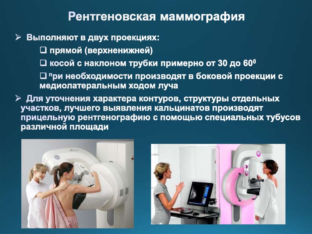 Маммография обязательно. Рентгеновская маммография. Маммография в двух проекциях. Мамаогра.