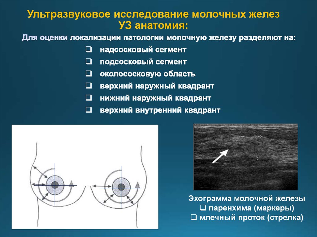 Исследования грудного. Молочная железа УЗИ анатомия. Плоскости сканирования молочных желез. Верхне-наружный Квадрант молочной железы. УЗИ анатомия молочных желез.