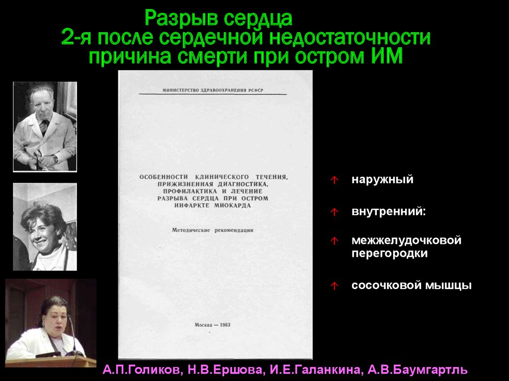Разрыв сердца 2-я после сердечной недостаточности причина смерти при остром ИМ