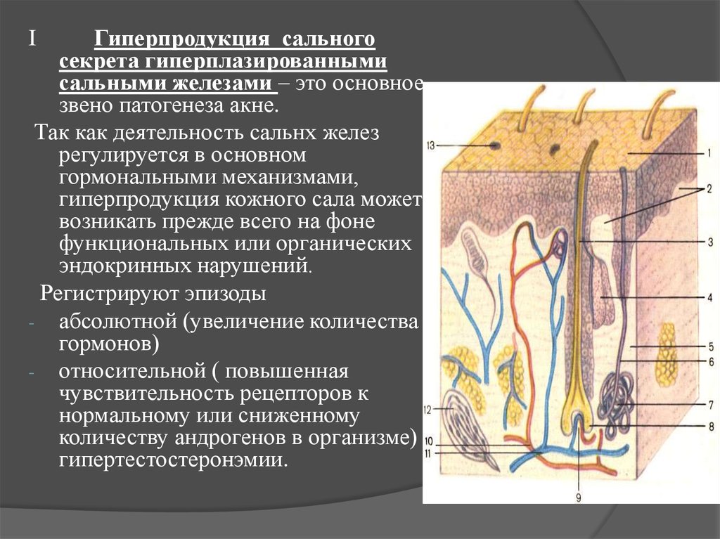 Активность сальных желез. Механизм развития угревой болезни. Гиперплазия сальных желез. Заболевание сальных желез.